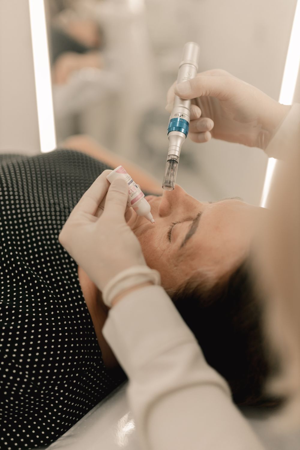 Illustration d’une séance de microneedling